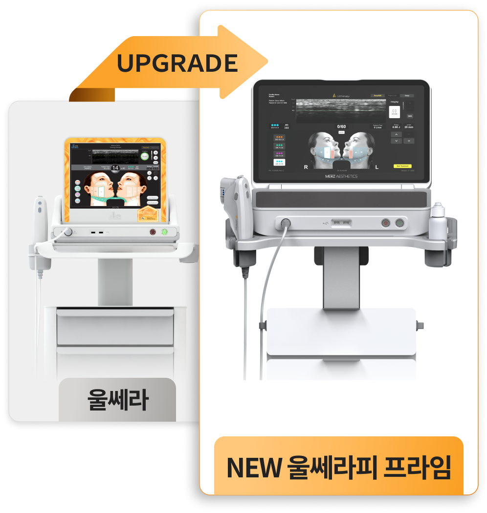 Ultherapy Prime 升级版仪器手机端图像