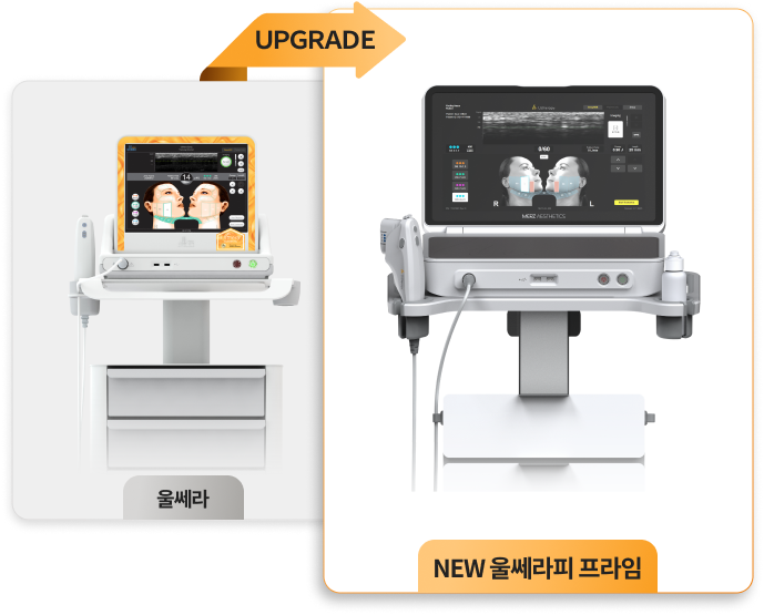 Ultherapy Prime 升级版仪器图像