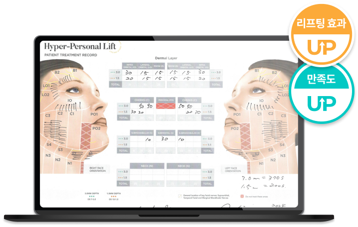 无需担心脸颊凹陷的 Ultherapy Prime 施术方案说明图像