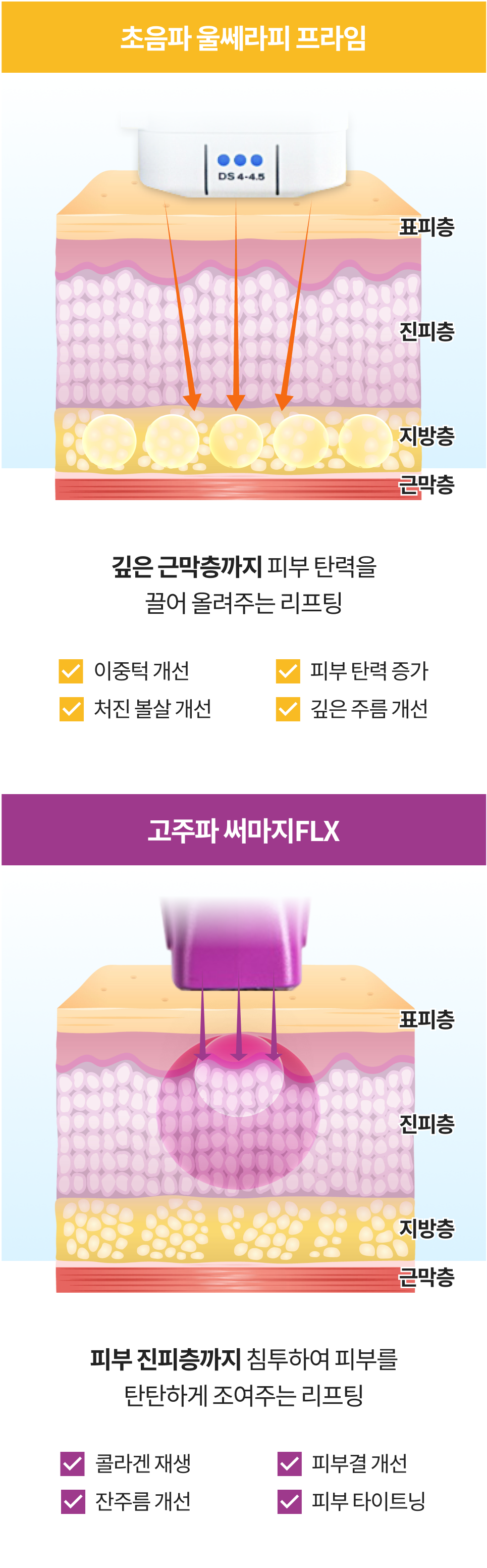 同时护理皮肤深层与浅层的超声玛吉双重拉提移动端说明图像