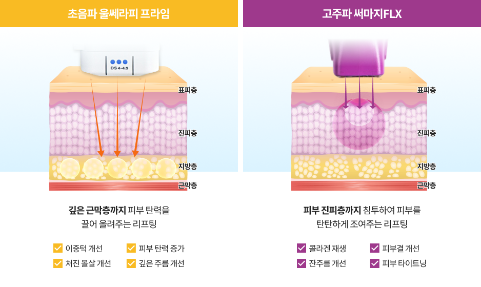 同时护理皮肤深层与浅层的超声玛吉双重拉提说明图像