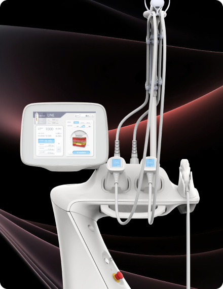 UltraLine 以强效超声波精准作用于深层脂肪层的疗程介绍图片